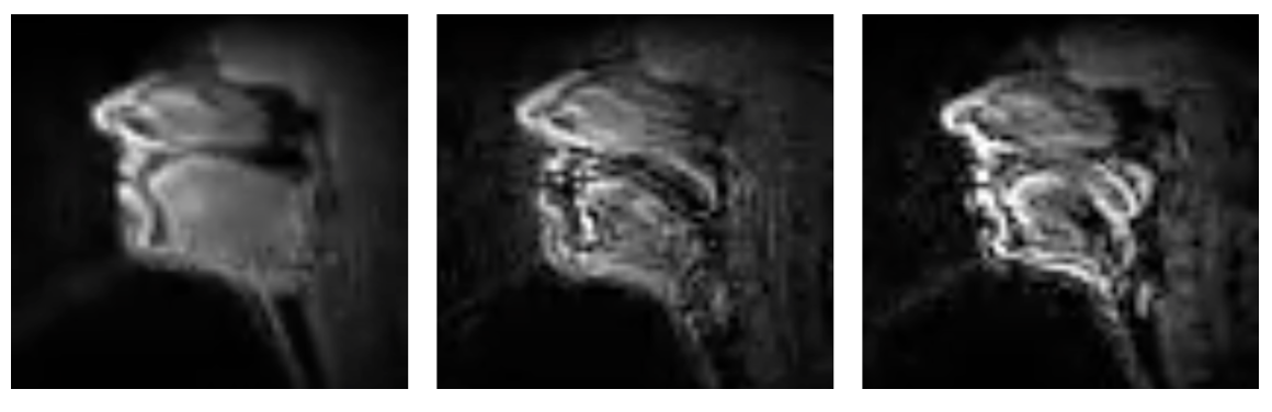 Speech Synthesis From Silent rtMRI Videos