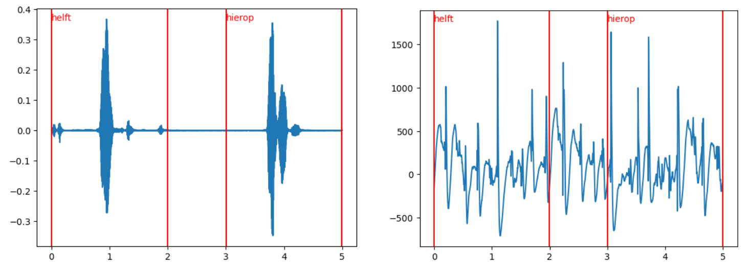 Speech Onset Detection Using sEEG