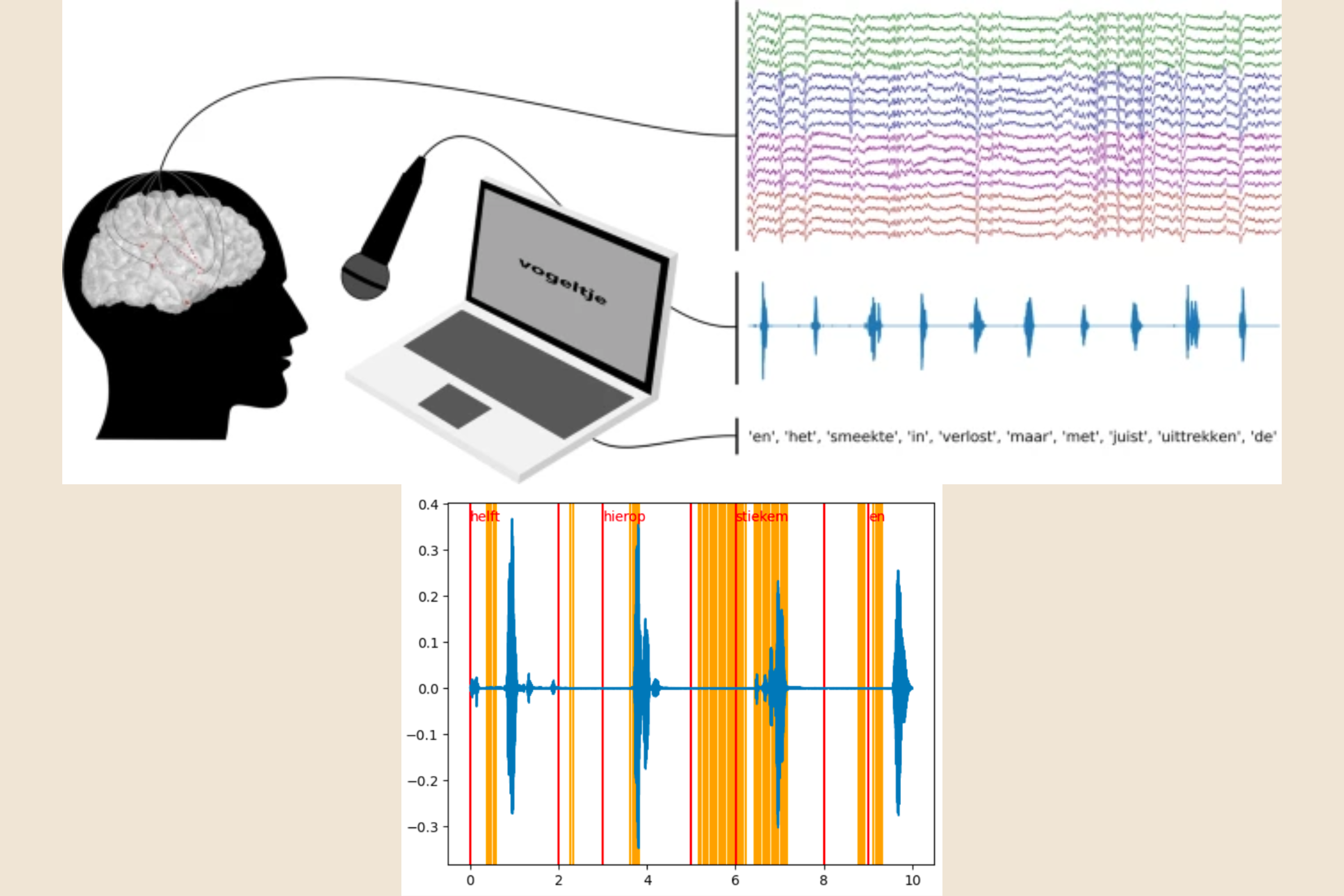 Speech Onset Detection Using sEEG